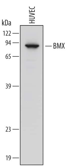 ETK Antibody in Western Blot (WB)
