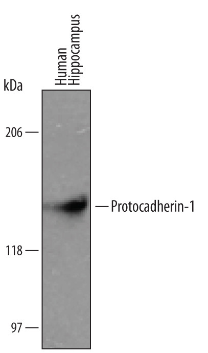 PCDH1 Antibody in Western Blot (WB)