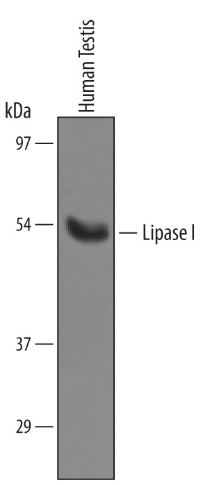 LIPI Antibody in Western Blot (WB)
