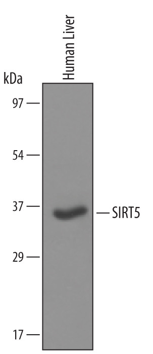 SIRT5 Antibody in Western Blot (WB)