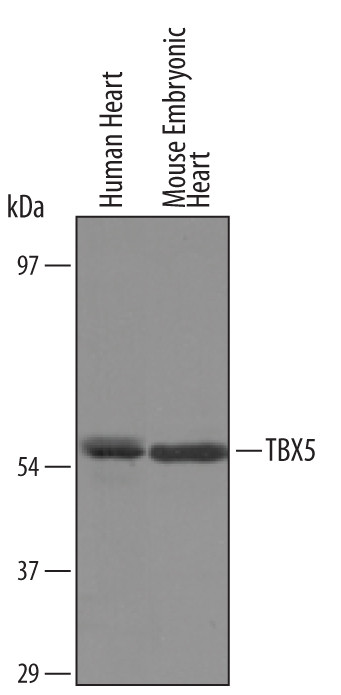 TBX5 Antibody in Western Blot (WB)