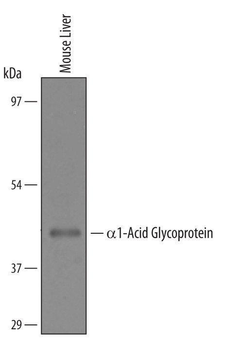 ORM1 Antibody in Western Blot (WB)
