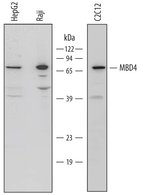 MBD4 Antibody in Western Blot (WB)