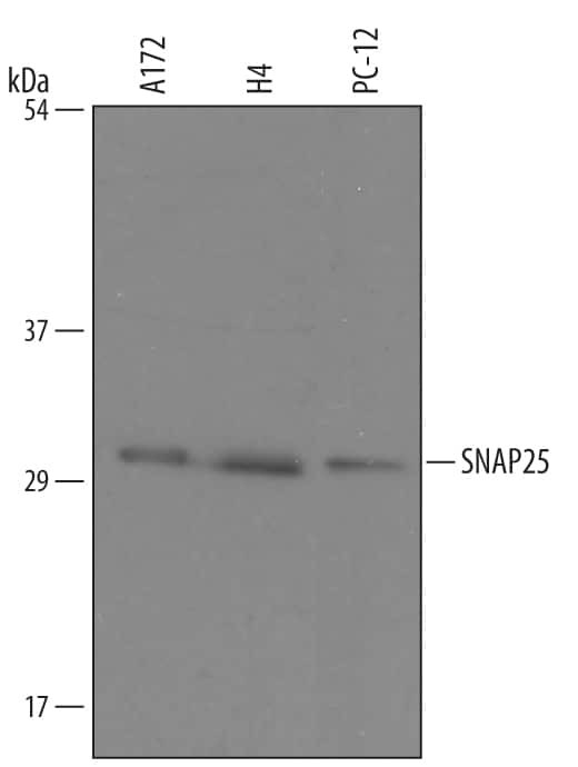 SNAP25 Antibody in Western Blot (WB)