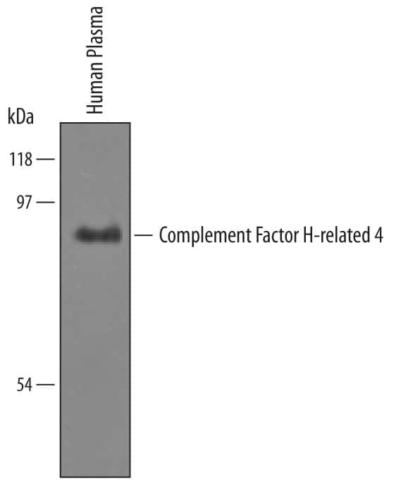 CFHR4 Antibody in Western Blot (WB)