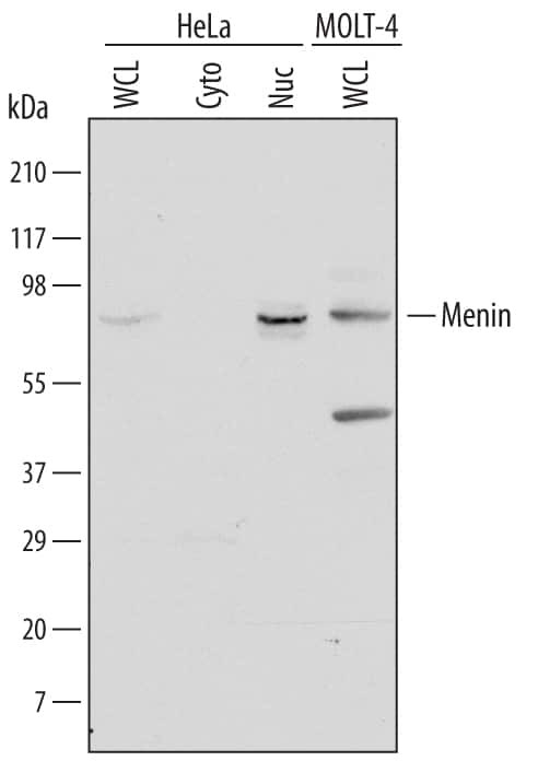 Menin Antibody in Western Blot (WB)