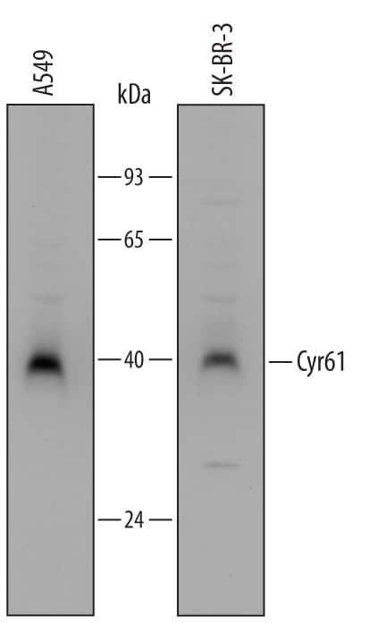 CYR61 Antibody in Western Blot (WB)