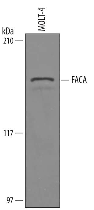 FANCA Antibody in Western Blot (WB)