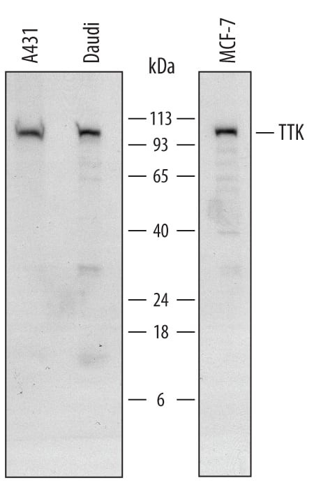 TTK Antibody in Western Blot (WB)