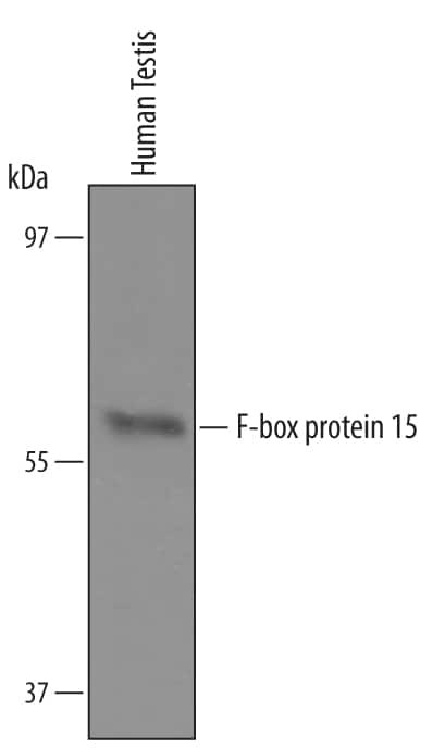 FBXO15 Antibody in Western Blot (WB)