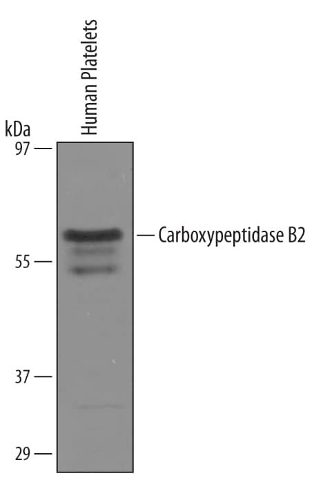 Carboxypeptidase B2 Antibody in Western Blot (WB)