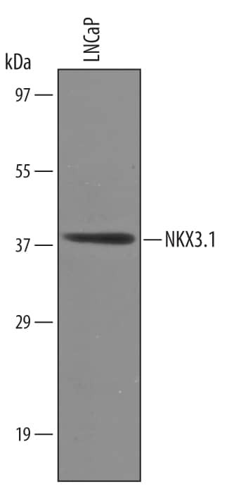 Nkx3.1 Antibody in Western Blot (WB)