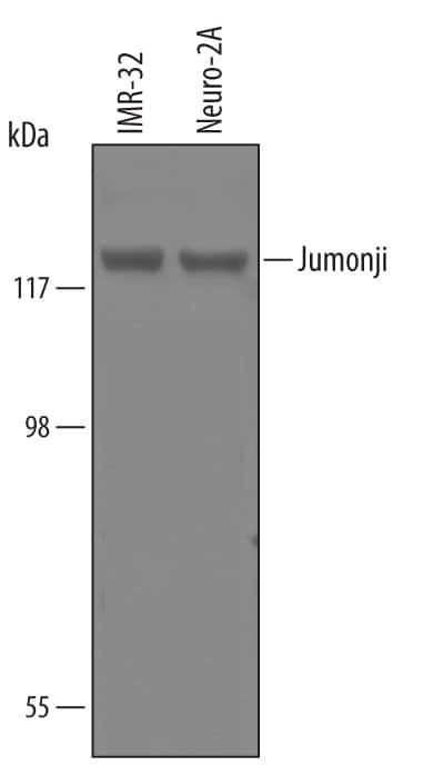 JARID2 Antibody in Western Blot (WB)
