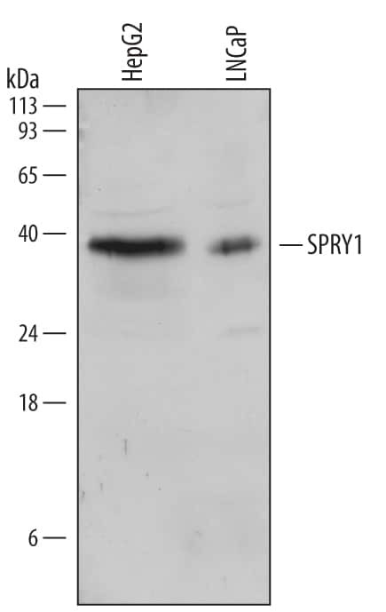 SPRY1 Antibody in Western Blot (WB)