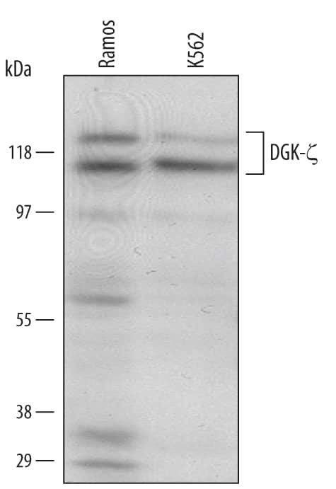 DGKZ Antibody in Western Blot (WB)