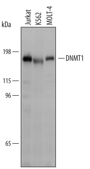 DNMT1 Antibody in Western Blot (WB)