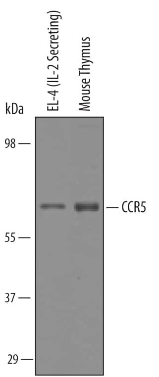CCR5 Antibody in Western Blot (WB)