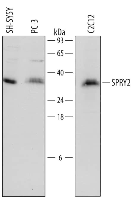 SPRY2 Antibody in Western Blot (WB)