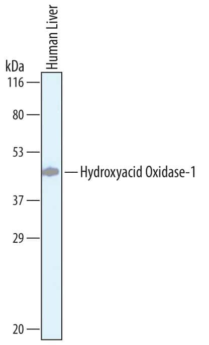 HAO1 Antibody in Western Blot (WB)