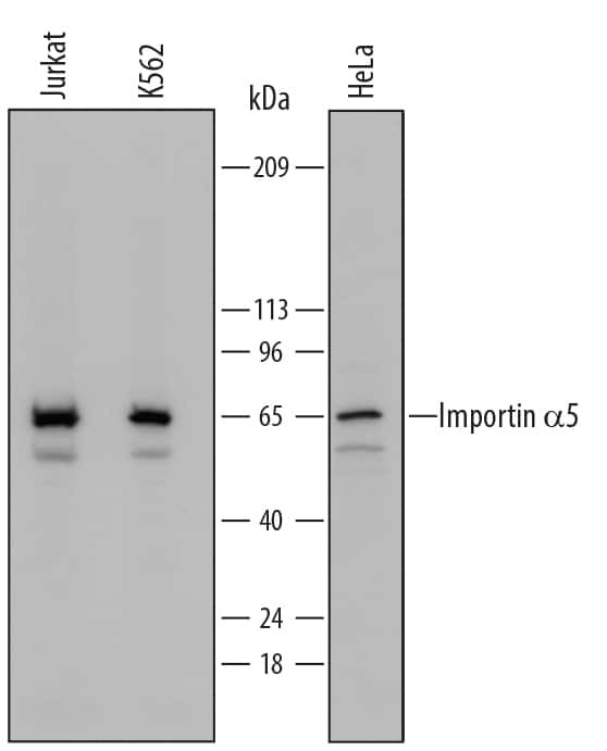 KPNA1 Antibody in Western Blot (WB)