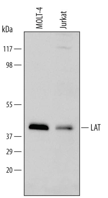 LAT Antibody in Western Blot (WB)