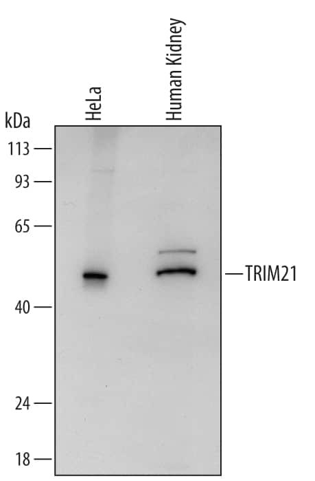 TRIM21 Antibody in Western Blot (WB)