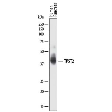 TPST2 Antibody in Western Blot (WB)