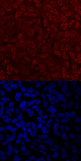 TWIST2 Antibody in Immunocytochemistry (ICC/IF)