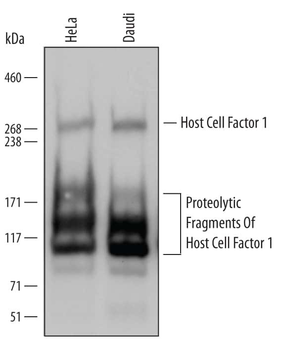 HCFC1 Antibody in Western Blot (WB)
