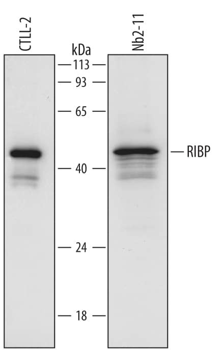 SH2D2A Antibody in Western Blot (WB)