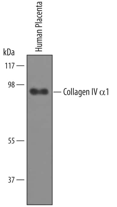 COL4A1 Antibody in Western Blot (WB)