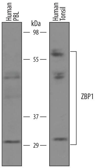 ZBP1 Antibody in Western Blot (WB)