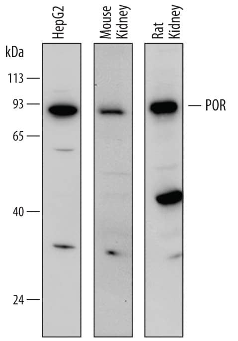 Cytochrome P450 Reductase Antibody in Western Blot (WB)