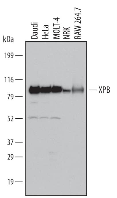 XPB Antibody in Western Blot (WB)