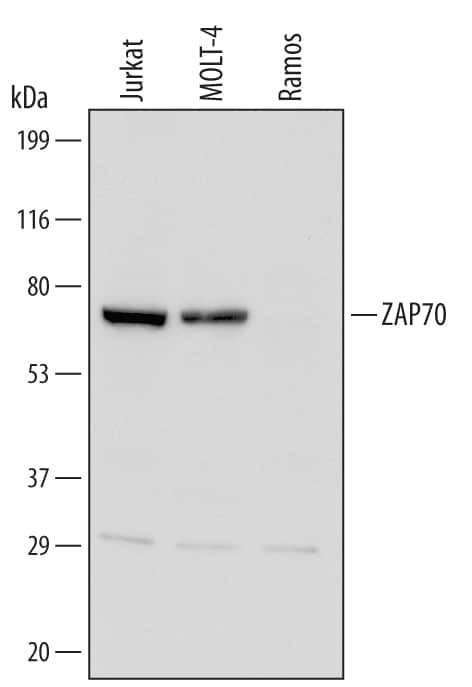 Zap-70 Antibody in Western Blot (WB)