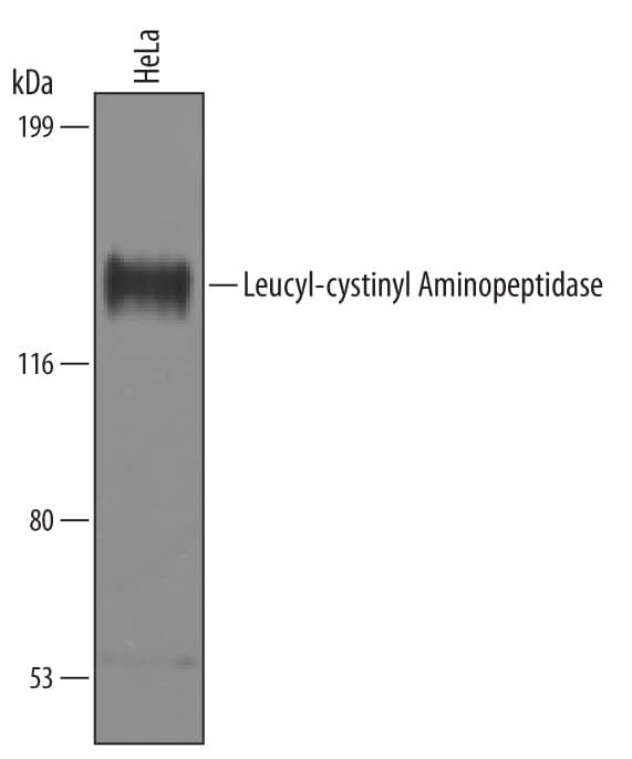 LNPEP Antibody in Western Blot (WB)