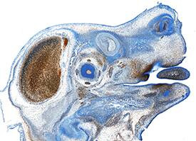 EphA3 Antibody in Immunohistochemistry (Frozen) (IHC (F))