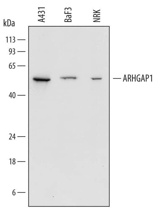 RhoGAP Antibody in Western Blot (WB)