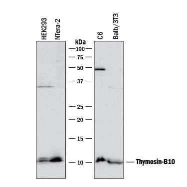 TMSB10 Antibody in Western Blot (WB)