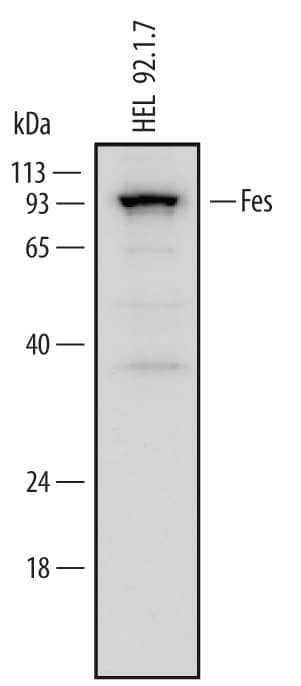 FES Antibody in Western Blot (WB)