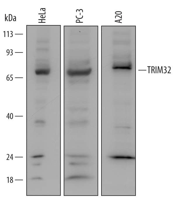 TRIM32 Antibody in Western Blot (WB)