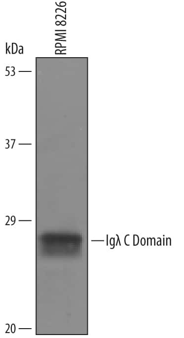 IGLC2 Antibody in Western Blot (WB)