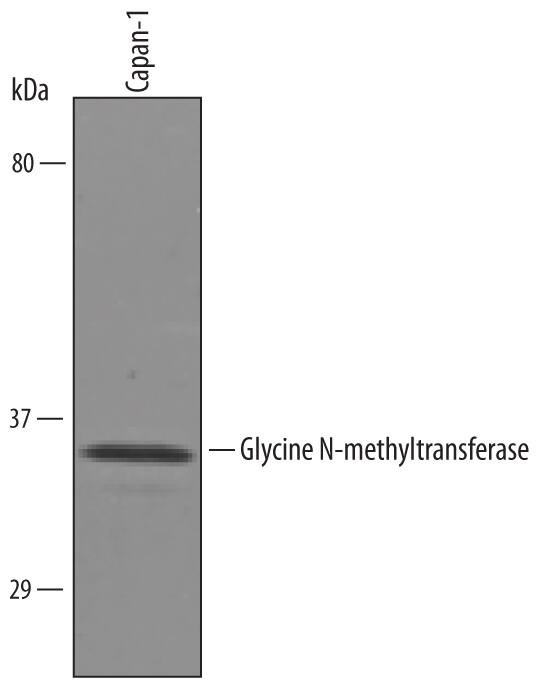 GNMT Antibody in Western Blot (WB)