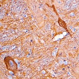 DDAH1 Antibody in Immunohistochemistry (Paraffin) (IHC (P))