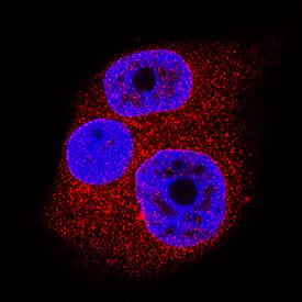 SENP1 Antibody in Immunocytochemistry (ICC/IF)
