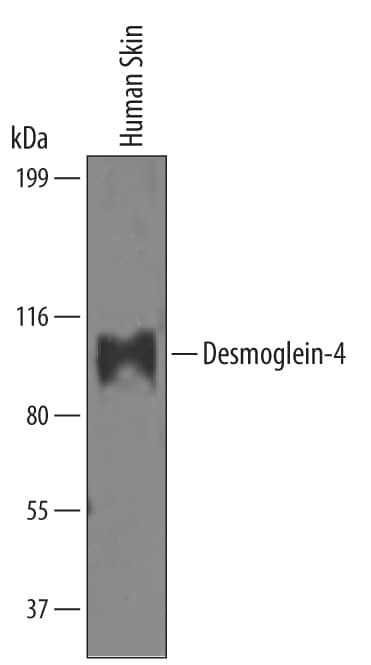 Desmoglein 4 Antibody in Western Blot (WB)