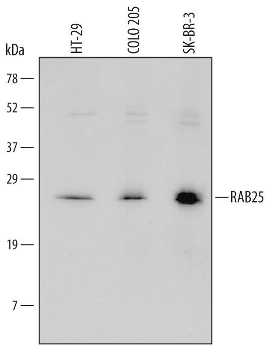 RAB25 Antibody in Western Blot (WB)