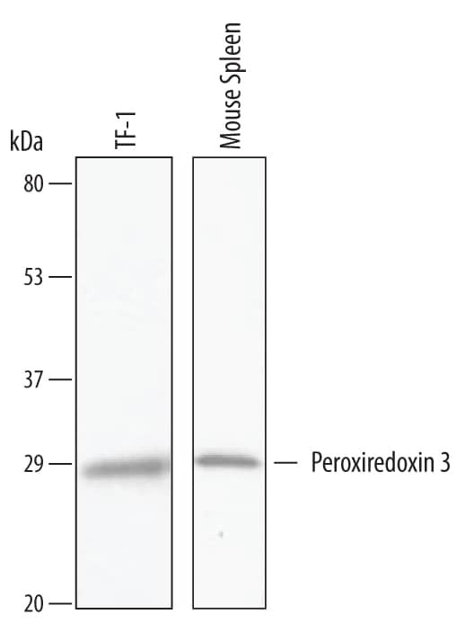 PRDX3 Antibody in Western Blot (WB)