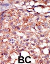 RIPK4 Antibody in Immunohistochemistry (Paraffin) (IHC (P))