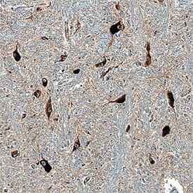 STX12 Antibody in Immunohistochemistry (Paraffin) (IHC (P))